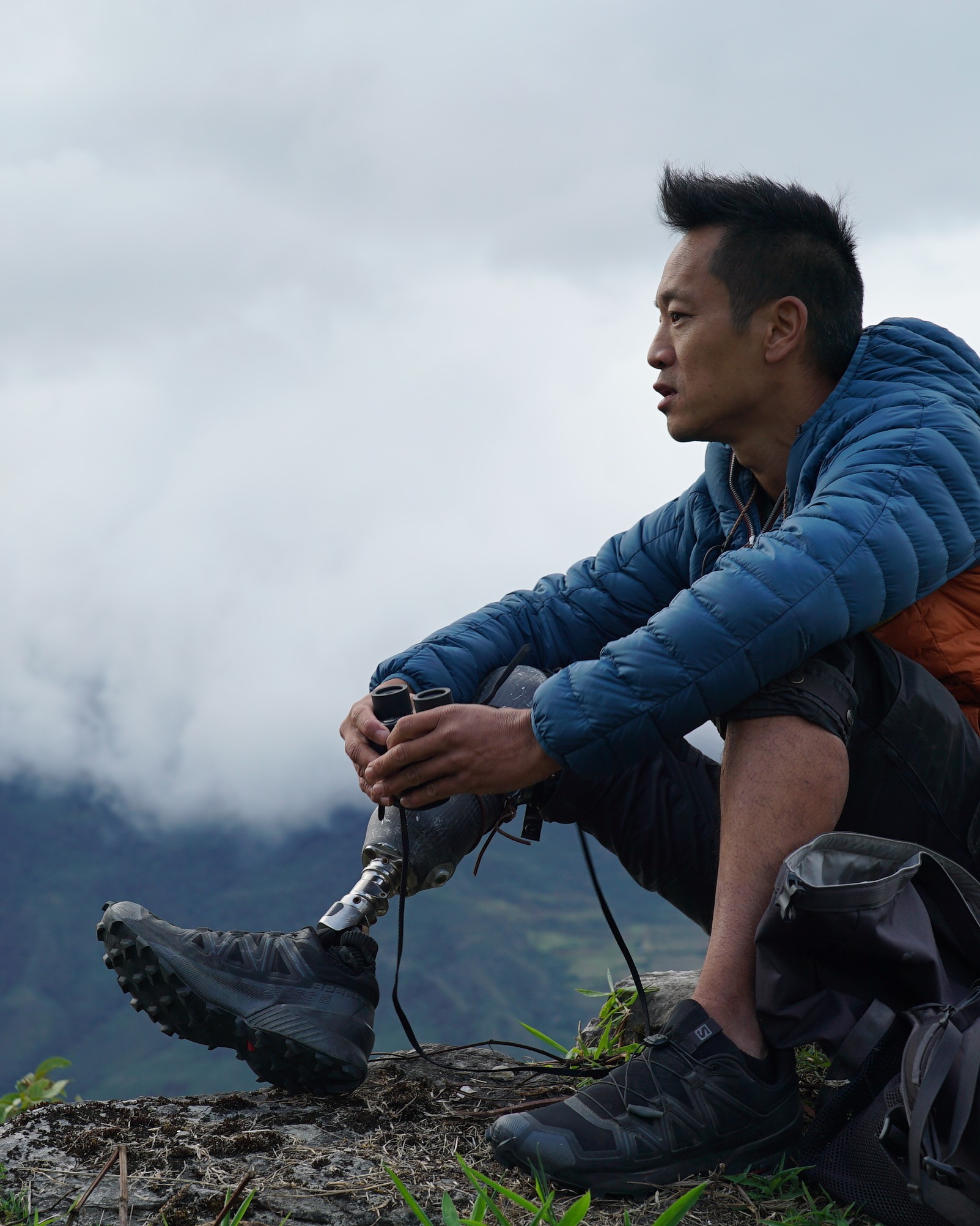 Dr. Albert Lin, a below-knee amputee, on a mountain ridge with his full prosthetic leg visible