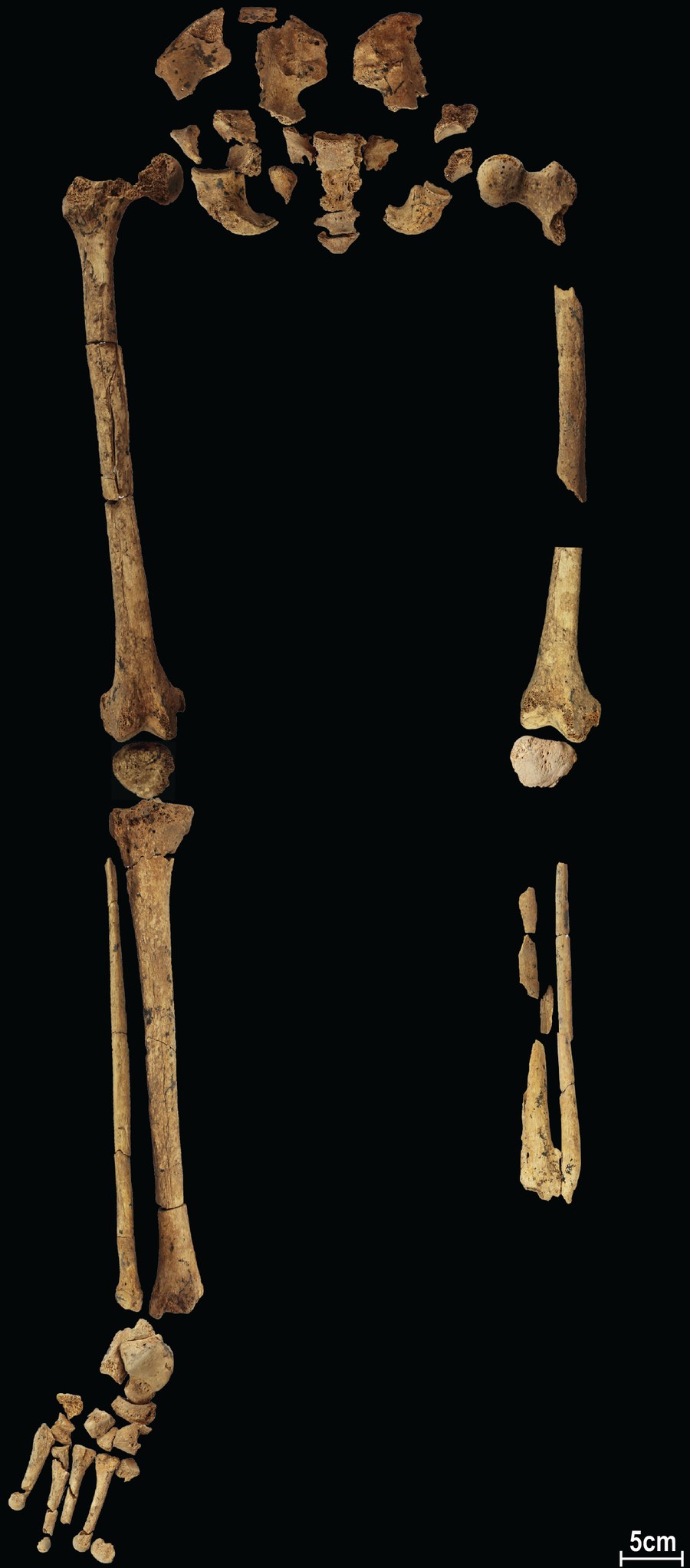 The full skeleton of Tebo 1, the 31,000-year-old amputee, from the Nature paper
